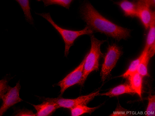 HDAC6 Antibody in Immunocytochemistry (ICC/IF)