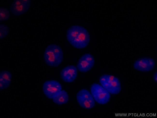 RBM15 Antibody in Immunocytochemistry (ICC/IF)