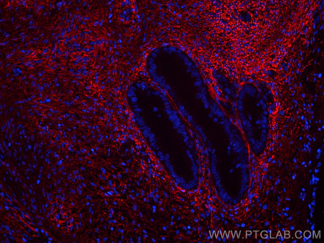 EMILIN1 Antibody in Immunohistochemistry (Paraffin) (IHC (P))