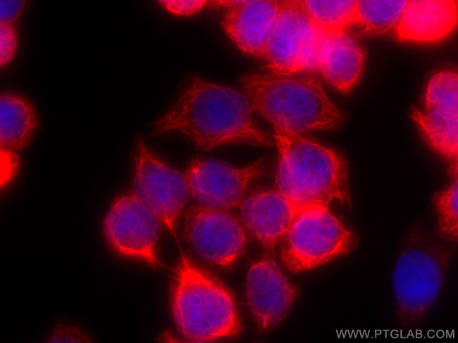 Cytokeratin 20 Antibody in Immunocytochemistry (ICC/IF)