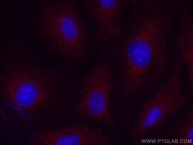 MMP3 Antibody in Immunocytochemistry (ICC/IF)
