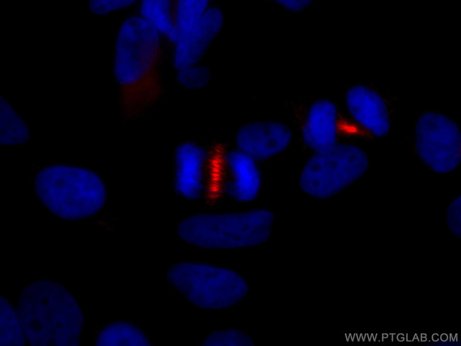 PRC1 Antibody in Immunocytochemistry (ICC/IF)