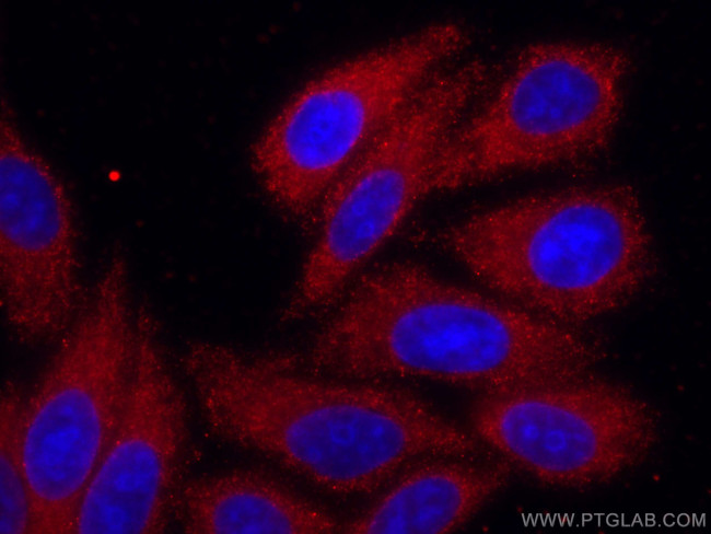 ALDH5A1 Antibody in Immunocytochemistry (ICC/IF)