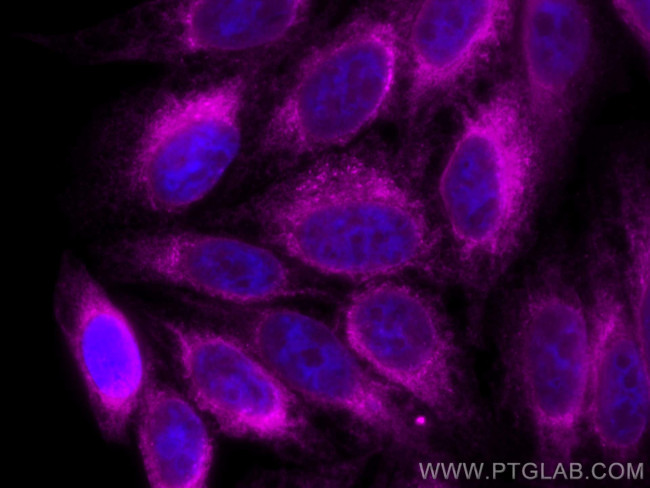 calreticulin Antibody in Immunocytochemistry (ICC/IF)