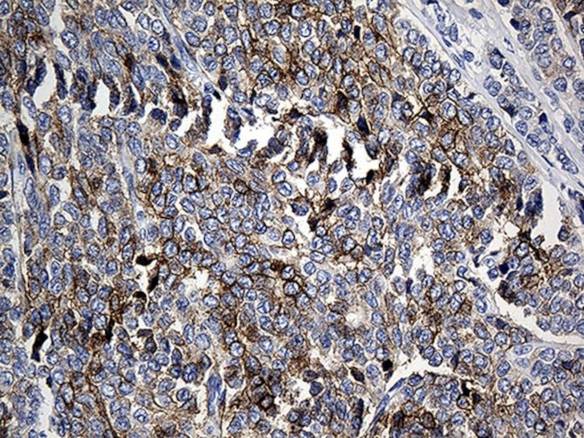 CLEC10A Antibody in Immunohistochemistry (Paraffin) (IHC (P))