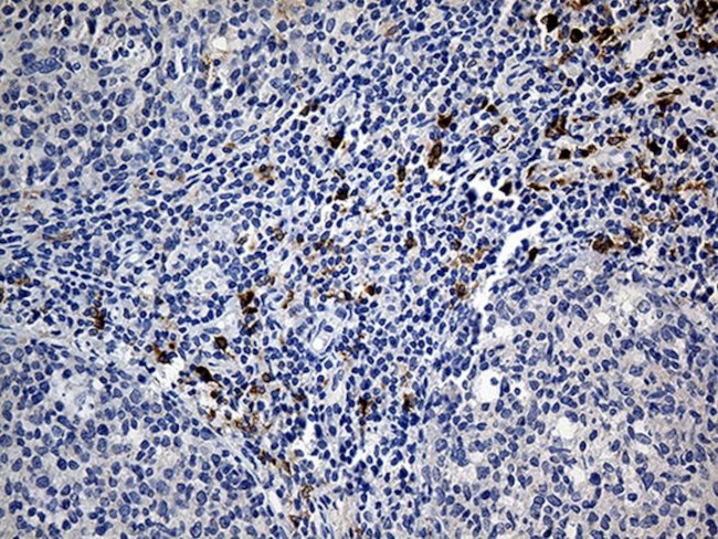 CLEC10A Antibody in Immunohistochemistry (Paraffin) (IHC (P))