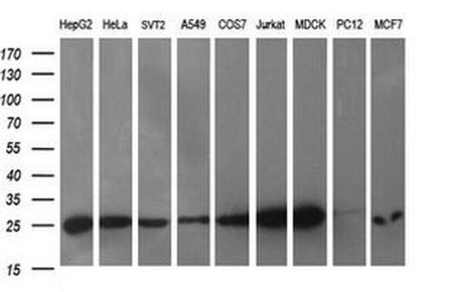 CMPK1 Antibody in Western Blot (WB)