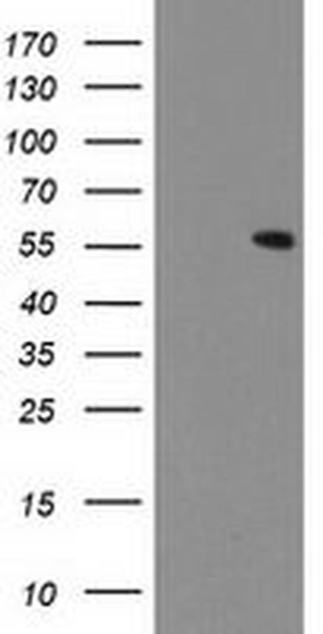 CNDP2 Antibody in Western Blot (WB)