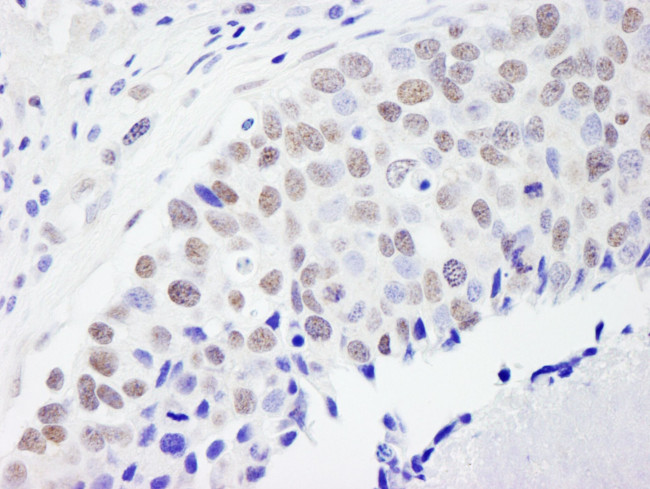 CPSF59 Antibody in Immunohistochemistry (IHC)