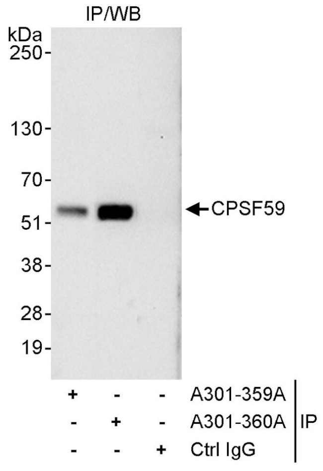 CPSF59 Antibody in Immunoprecipitation (IP)