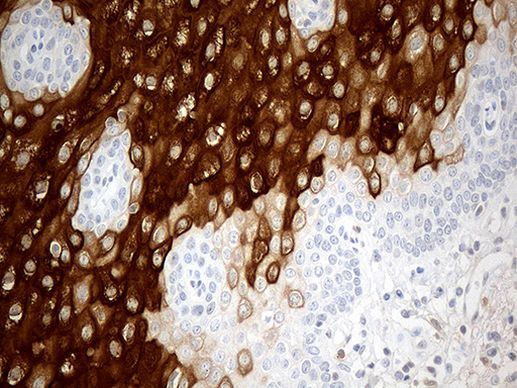 CRNN Antibody in Immunohistochemistry (Paraffin) (IHC (P))