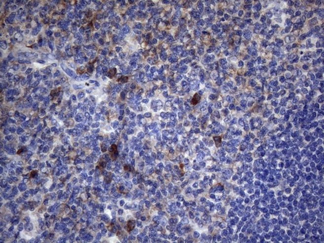 CRP Antibody in Immunohistochemistry (Paraffin) (IHC (P))