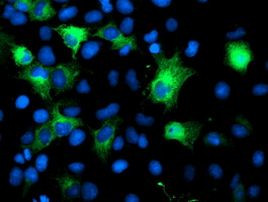 CRYAB Antibody in Immunocytochemistry (ICC/IF)