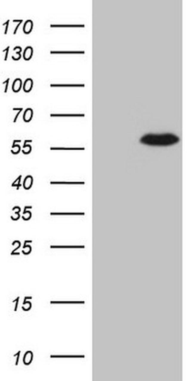 CSNK1G1 Antibody in Western Blot (WB)