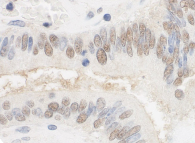 CSTF2T/TauCSTF64 Antibody in Immunohistochemistry (IHC)