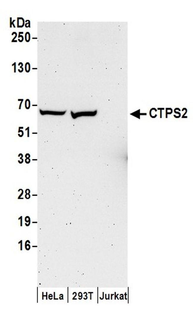 CTPS2 Antibody in Western Blot (WB)