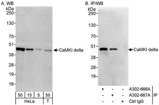 CaMKI delta Antibody in Western Blot (WB)