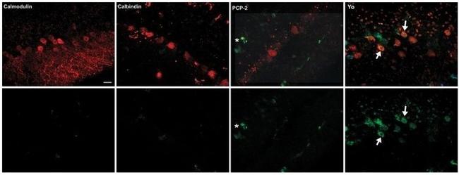 Calbindin D28K Antibody in Immunocytochemistry (ICC/IF)