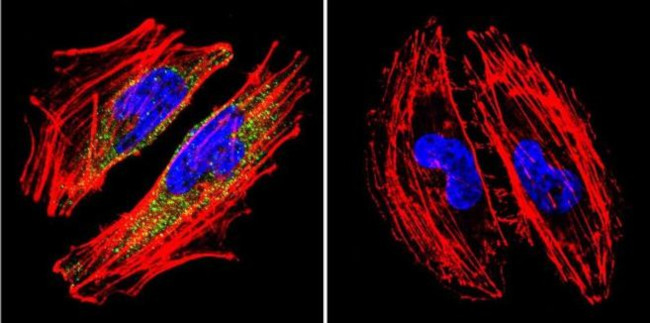 alpha Catenin Antibody in Immunocytochemistry (ICC/IF)