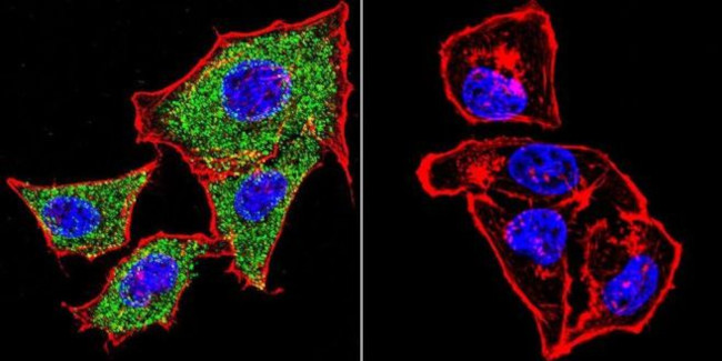 alpha Catenin Antibody in Immunocytochemistry (ICC/IF)