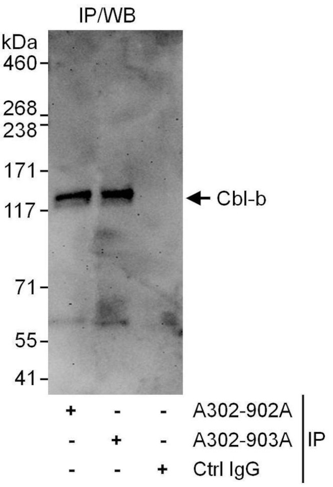 Cbl-b Antibody in Immunoprecipitation (IP)