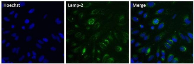 LAMP2 Antibody in Immunocytochemistry (ICC/IF)