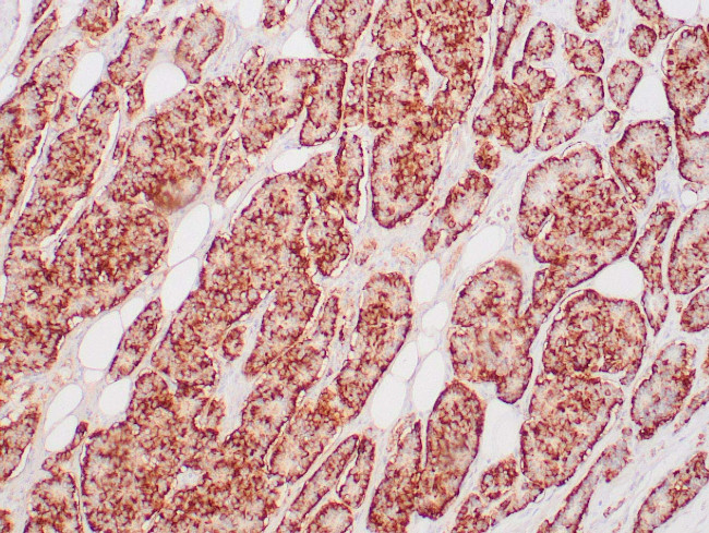 Chromogranin A Monoclonal Antibody (ZM12) (Z2347MS)