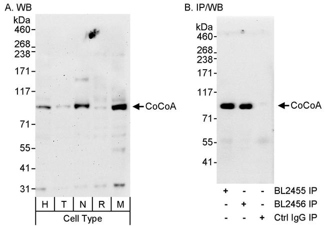 CoCoA Antibody in Western Blot (WB)