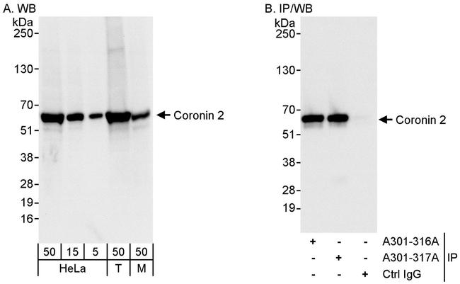 Coronin 2 Antibody in Western Blot (WB)