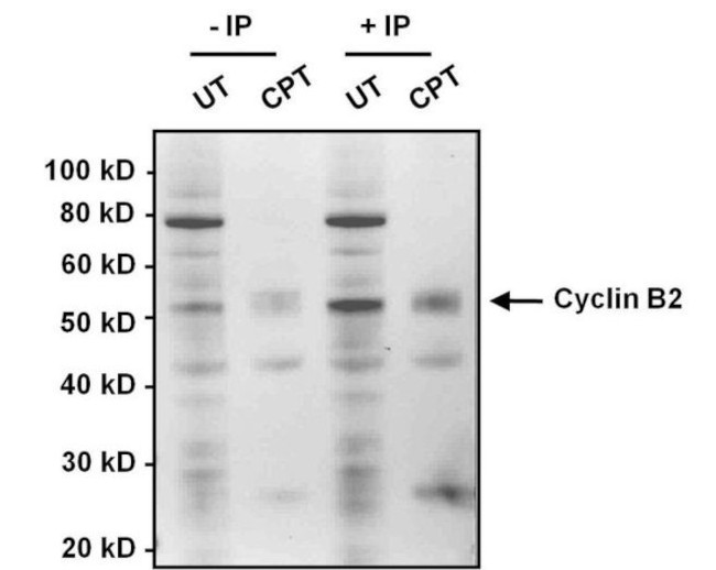 Cyclin B2 Antibody in Immunoprecipitation (IP)