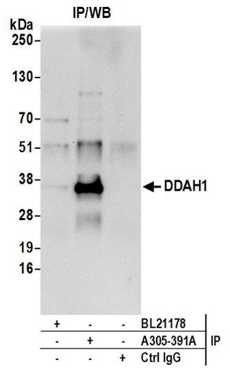 DDAH1 Antibody in Immunoprecipitation (IP)