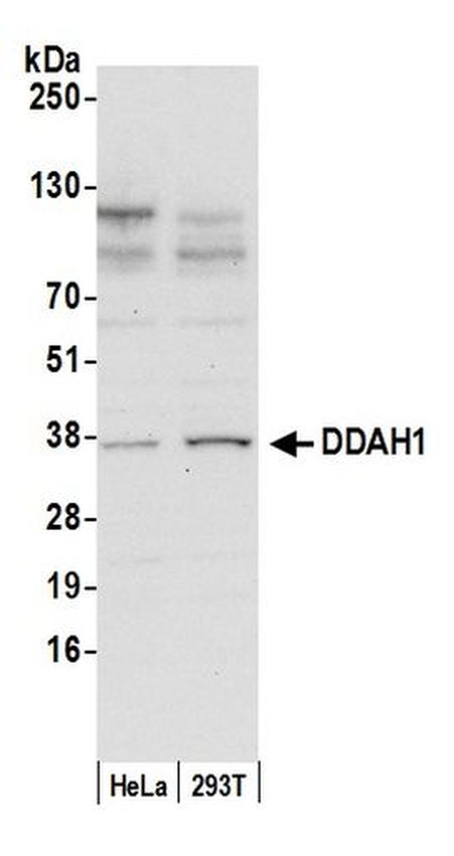 DDAH1 Antibody in Western Blot (WB)