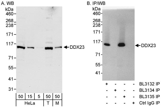 DDX23 Antibody in Western Blot (WB)