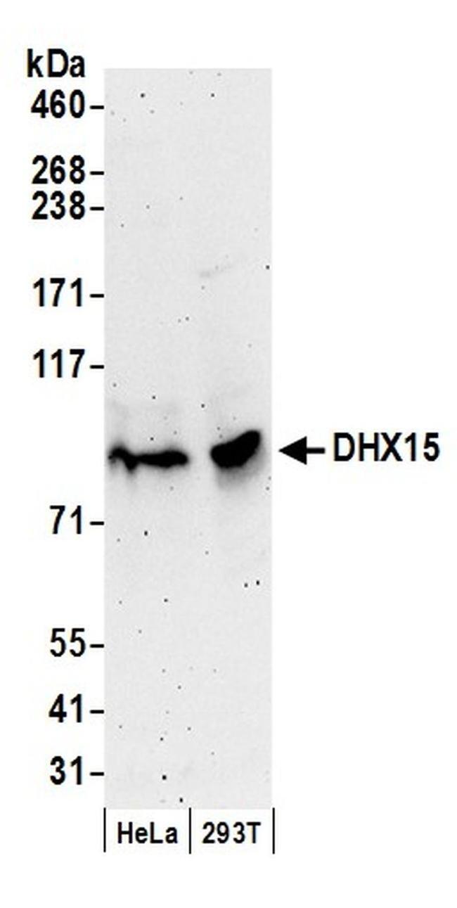 DHX15 Antibody in Western Blot (WB)