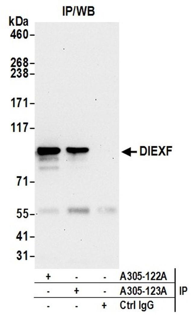 DIEXF/C1orf107 Antibody in Western Blot (WB)