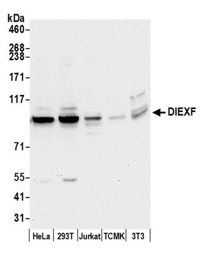 DIEXF/C1orf107 Antibody in Western Blot (WB)