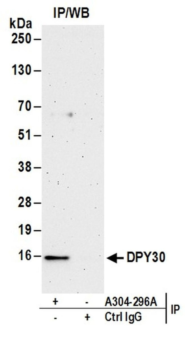 Dpy30 Polyclonal Antibody A304 296a T 1472