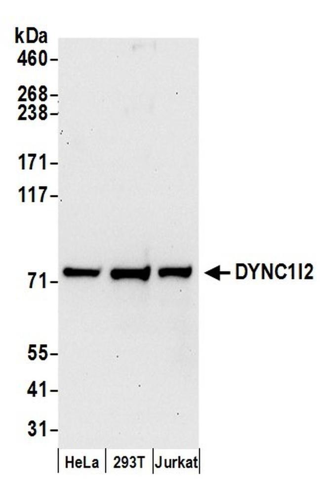 DYNC1I2 Antibody in Western Blot (WB)