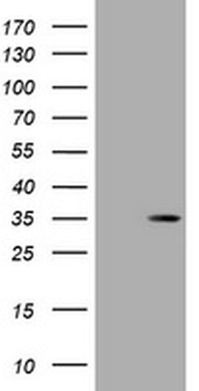 DsRed-Monomer Antibody in Western Blot (WB)