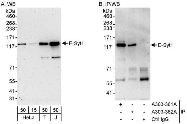 E-Syt1 Antibody in Western Blot (WB)