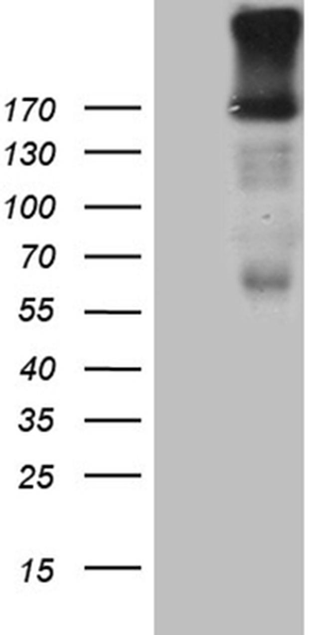 EGF Antibody in Western Blot (WB)