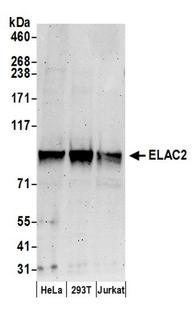 ELAC2 Antibody in Western Blot (WB)