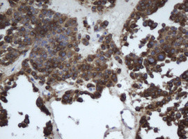 EPHX1 Antibody in Immunohistochemistry (Paraffin) (IHC (P))