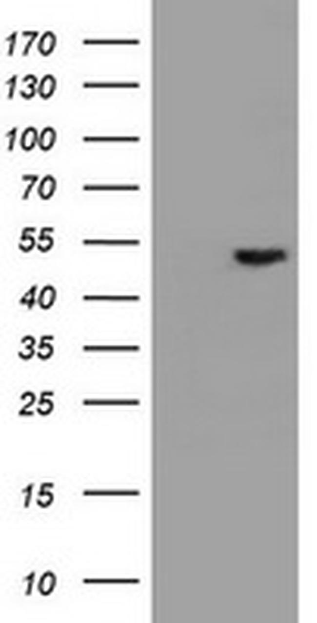 EPHX1 Antibody in Western Blot (WB)