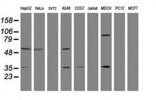 EPHX1 Antibody in Western Blot (WB)