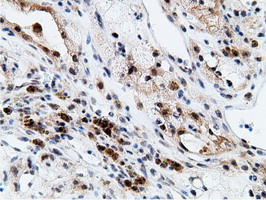 EPM2AIP1 Antibody in Immunohistochemistry (Paraffin) (IHC (P))