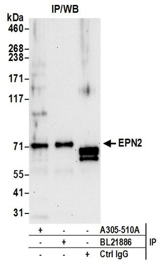 EPN2 Antibody in Immunoprecipitation (IP)