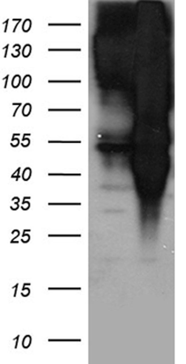 EPS15 Antibody in Western Blot (WB)