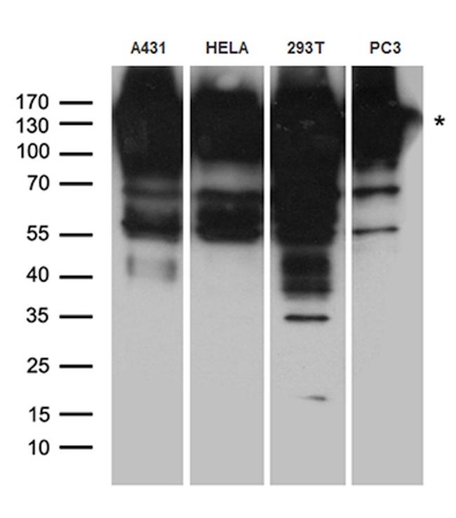 EPS15 Antibody in Western Blot (WB)