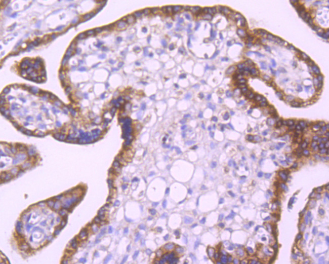 EGFR Antibody in Immunohistochemistry (Paraffin) (IHC (P))